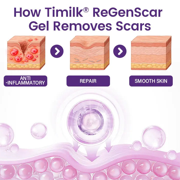 TIMILK Advanced Scarvanisher Gel | Fast-Acting Scar & Stretch Mark Reduction | 30g