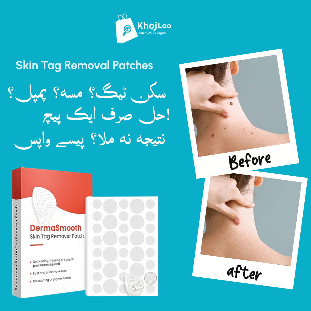 DermaSmooth Skin Tag Remover Patch