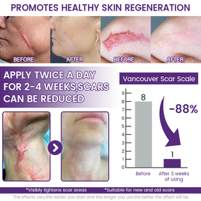 TIMILK Advanced Scarvanisher Gel | Fast-Acting Scar & Stretch Mark Reduction | 30g
