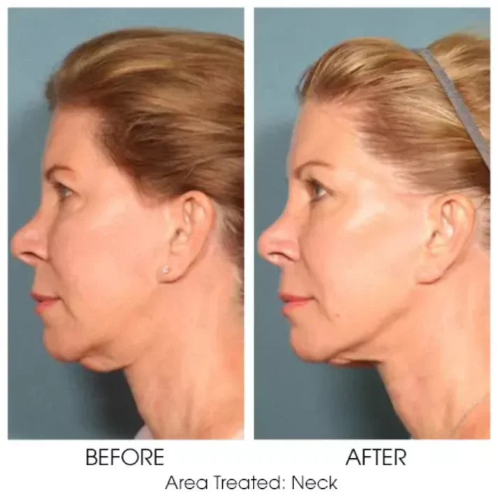 Magec Collagen Fullerene Neck Cream - Tightening & Anti-Wrinkle Formula