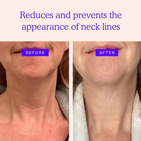Magec Collagen Fullerene Neck Cream - Tightening & Anti-Wrinkle Formula