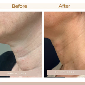 Magec Collagen Fullerene Neck Cream - Tightening & Anti-Wrinkle Formula