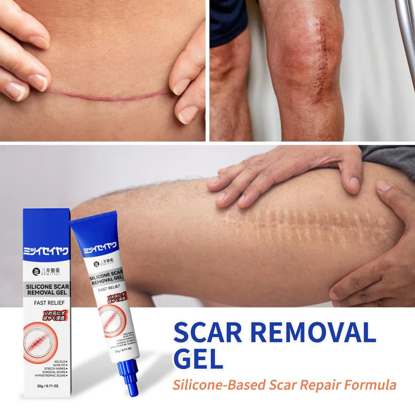 Scar Removal Gel for Old and New Scars