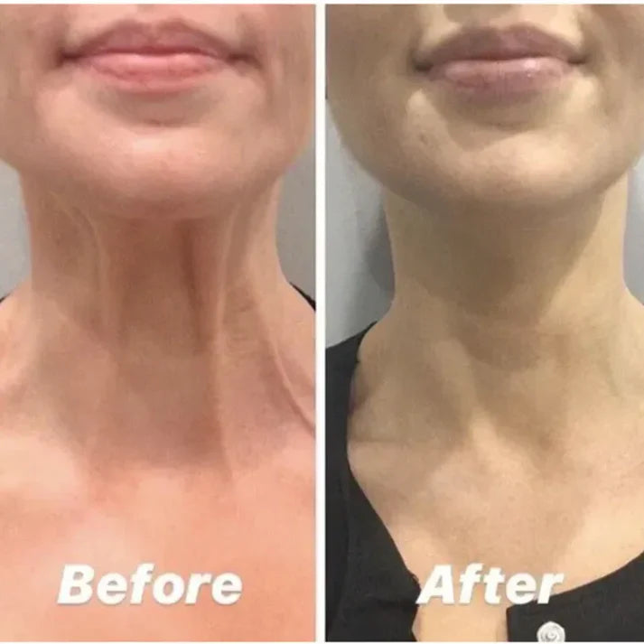 Magec Collagen Fullerene Neck Cream - Tightening & Anti-Wrinkle Formula