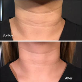 Magec Collagen Fullerene Neck Cream - Tightening & Anti-Wrinkle Formula