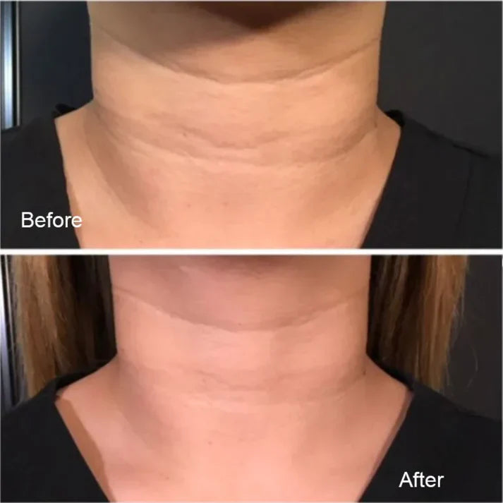 Magec Collagen Fullerene Neck Cream - Tightening & Anti-Wrinkle Formula