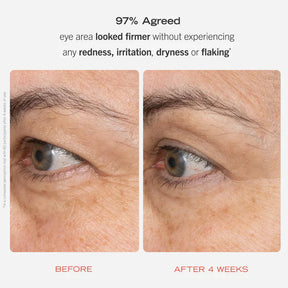 Magec Collagen Fullerene Neck Cream - Tightening & Anti-Wrinkle Formula