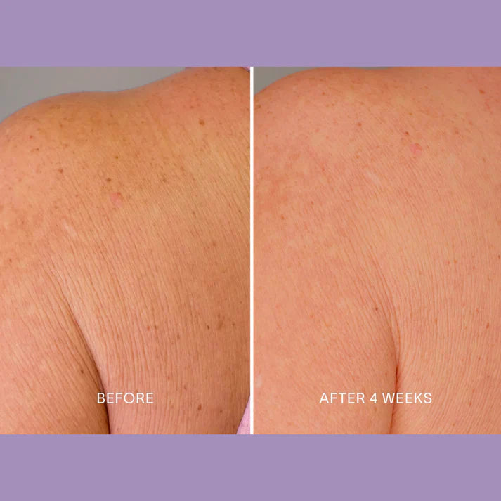 Magec Collagen Fullerene Neck Cream - Tightening & Anti-Wrinkle Formula