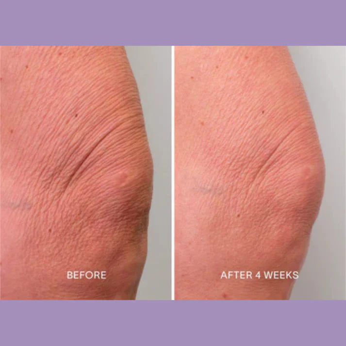 Magec Collagen Fullerene Neck Cream - Tightening & Anti-Wrinkle Formula