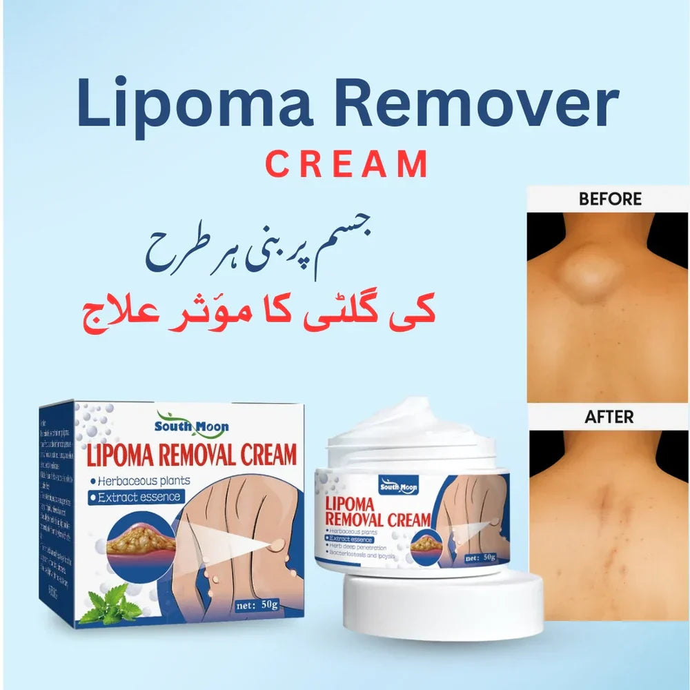Lipoma Removal Cream (IMPORTED)