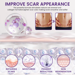TIMILK Advanced Scarvanisher Gel | Fast-Acting Scar & Stretch Mark Reduction | 30g